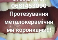 Стоматолог в КиєвіГарна якість і помірні ціни... Оголошення Bazarok.ua